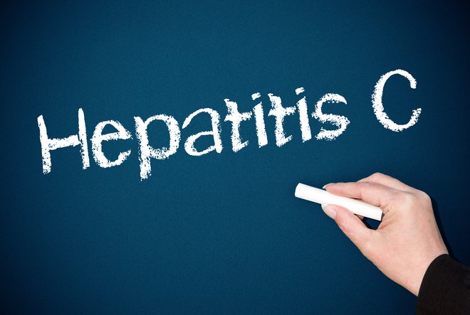 Hepatitis C: ne spreglejmo ga.  Foto: Shutterstock Foto