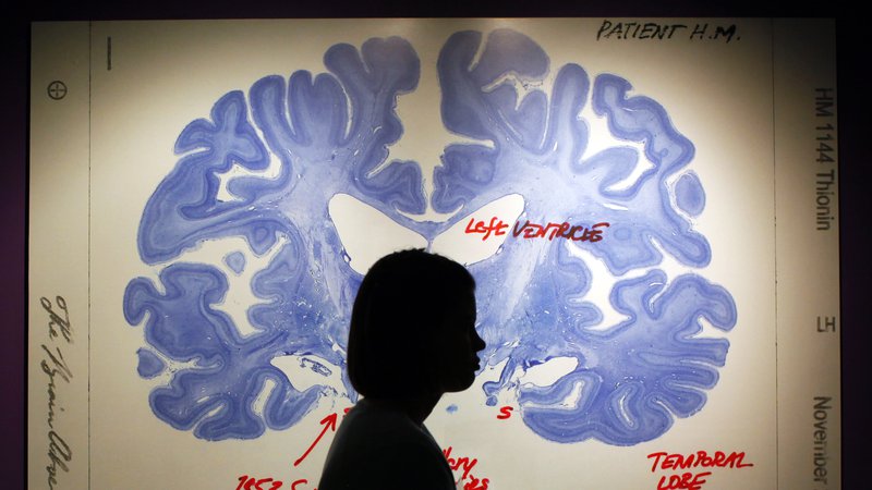 Fotografija: Ko se odločamo glede morebitnih dejanj, možgani pretehtajo, kdaj se splača vire porabiti in kdaj privarčevati, trdi nevrologinja Lisa Feldman Barrett. FOTO: Brian Snyder/Reuters