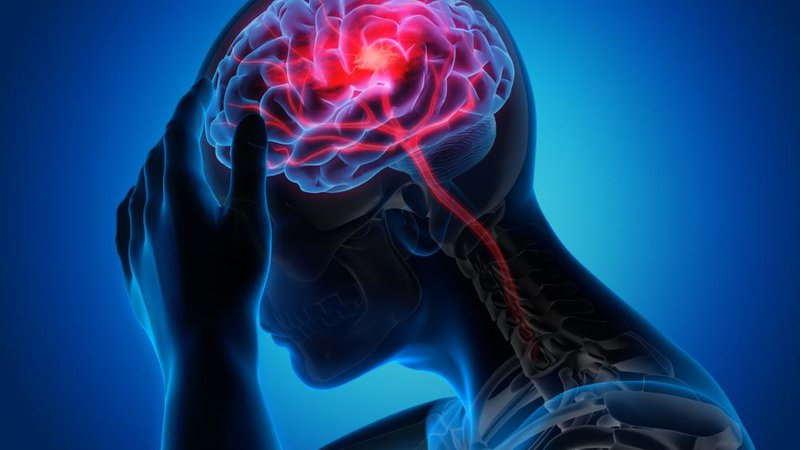 Fotografija: Epilepsija je nevrološka bolezen, ki po vsem svetu prizadene približno 50 milijonov ljudi. FOTO: Shutterstock

 