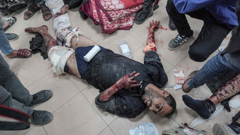 Fotografija: Palestinec, ranjen v izraelskem bombardiranju, čaka na zdravljenje v bolnišnici mučencev Al-Aksa v Deir el-Balahu v osrednjem delu Gaze. Izrael nadaljuje z napadi na mesto Rafa na jugu Gaze, kjer je zatočišče našlo več kot milijon Palestincev, mesto Al Nusejrat v osrednjem delu Gaze, kjer je bilo uničenih najmanj pet hiš, in območje Al Džabalija na severu. Foto: Afp