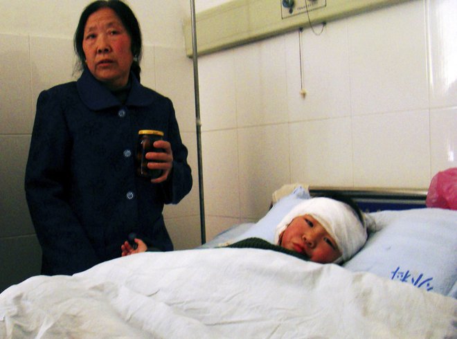Eden od ranjenih otrok iz vrtca v Taixingu na Kitajskem, kjer je leta 2010 neuravnovešeni napadalec z nožem ranil 28 ljudi. FOTO: China Daily/Reuters