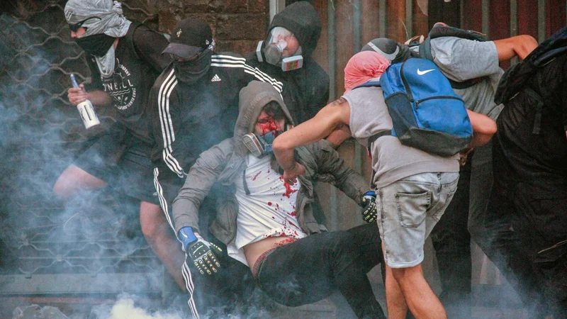 Fotografija: Spopadi s policijo se na množičnih protivladnih demostracijah v glavnem mestu Čila po enem mesecu še vedno nadaljujejo. Tokrat je v protestnike zapeljal avto in poškodoval več ljudi. Enega od njih prijatelji nosijo v varno zavetje. FOTO: Edgard Cross-buchanan/Afp
 