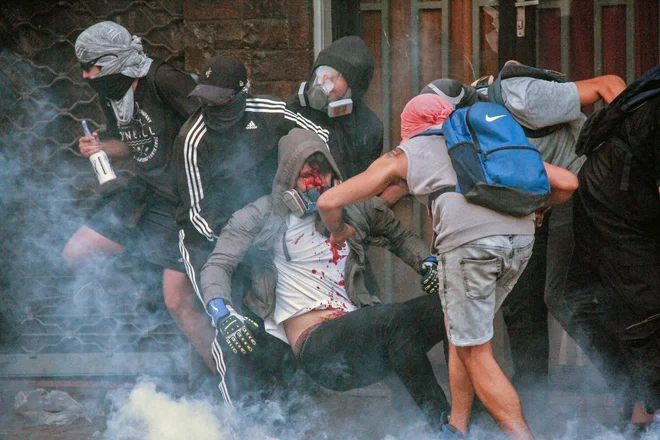 Spopadi s policijo se na množičnih protivladnih demostracijah v glavnem mestu Čila po enem mesecu še vedno nadaljujejo. Tokrat je v protestnike zapeljal avto in poškodoval več ljudi. Enega od njih prijatelji nosijo v varno zavetje. FOTO: Edgard Cross-buchanan/Afp<br />
