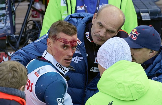 Poljak Piotr Zyla je imel srečo v nesreči, saj jo je – če odmislimo močno okrvavljen obraz – pri padcu odnesel odnesel brez hujših posledic. FOTO: Reuters