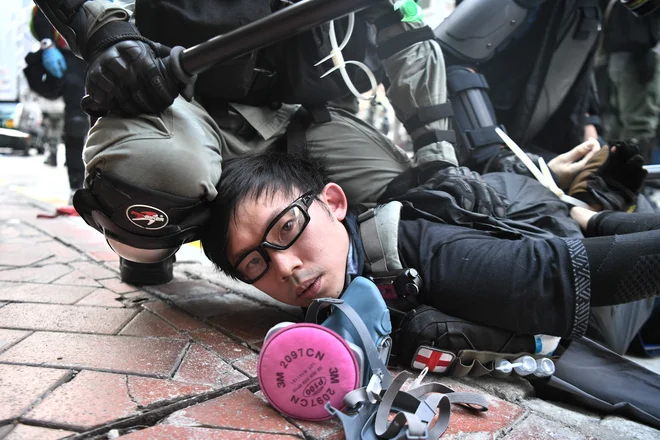 Celo ko so pripadniki varnostnih sil proti demonstrantom uporabili gumijaste krogle, so posledice občutili vsi, ki so se znašli na njihovi poti. FOTO: Anthony Wallace/AFP