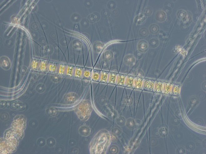 Kremenčasta alga <em>Chaetoceros affinis</em>, kot jo vidijo fitoplanktologi. Foto Patricija Mozetič