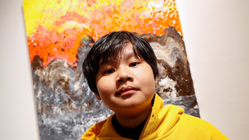 Fotografija: Xeo Chu, čudežni deček iz Vietnama razstavlja v New Yorku. FOTO: Shannon Stapleton/Reuters