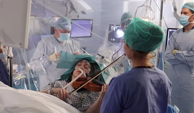Bolnica v londonski bolnišnici King&#39;s College je med težko operacijo na možganih igrala na violino. 53-letna Dagmar Turner je leta 2013 med igranjem z orkestrom doživela epileptični napad. Diagnosticirali so ji počasi rastoči možganski maligni tumor, ki je kljub zdravljenju z radioterapijo rasel naprej, zato so ga morali odstraniti. Glasbenica se je pred zahtevnim posegom zelo bala, da ne bo mogla več igrati violine. Njen tumor se je nahajal na desni strani čelnega režnja, blizu dela, ki nadzoruje premikanje njene leve roke. Priznani nevrolog Keyoumars Ashkan, ki je prav tako glasbenik oziroma pianist, ji je zato predlagal metodo, ki sicer danes ni takšna redkost. PHOTO: KING&#39;S COLLEGE HOSPITAL/Afp<br />
&nbsp;