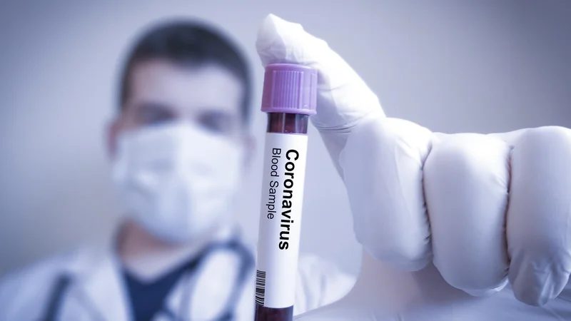 Glede na trenutno epidemiološko situacijo splošna uporaba zaščitnih mask ni potrebna. FOTO: Shutterstock