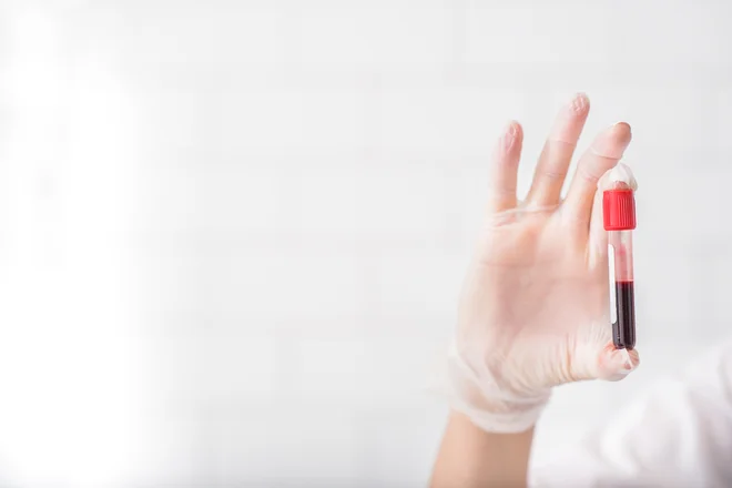 K slabši kakovosti pripomore tudi nezadosten in nesorazmeren vnos drugih hranil. FOTO: Shutterstock