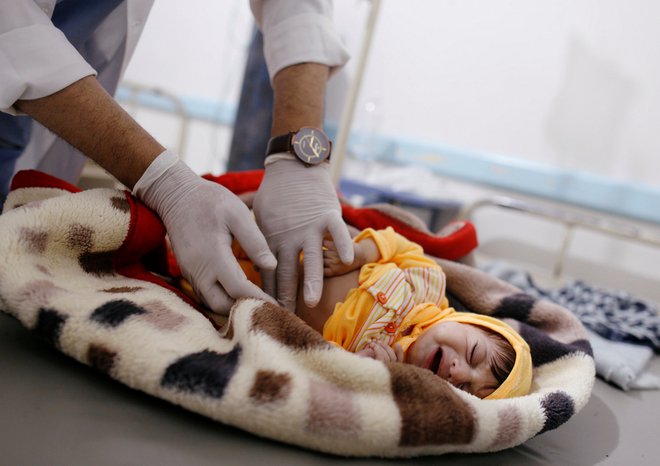 V štirih letih vojne je zaradi lakote umrlo najmanj 85.000 otrok mlajših od petih let. FOTO: Khaled Abdullah/Reuters