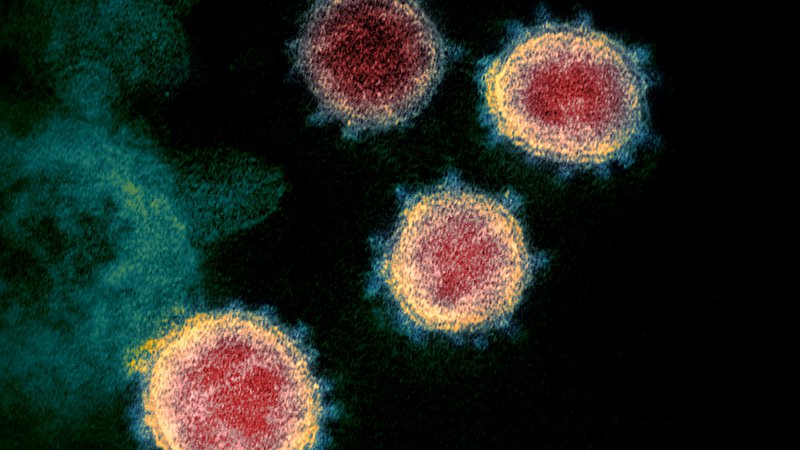 Fotografija: Po svetu se izvajajo projekti, ki se ukvarjajo z novim koronavirusom in temeljijo na umetni inteligenci. Raziskovalci že poročajo o pozitivnih rezultatih. Foto Reuters