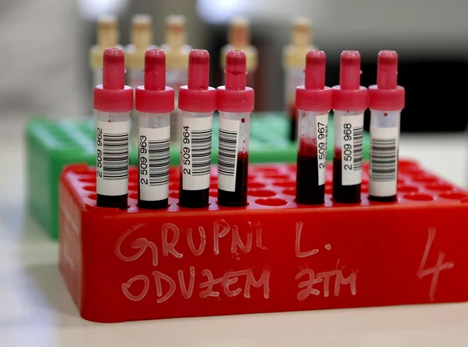 Veliko dela nas še čaka: urediti status centra za hemofilijo in zagotoviti varnost podatkov v registru. FOTO: Aleš Černivec/Delo