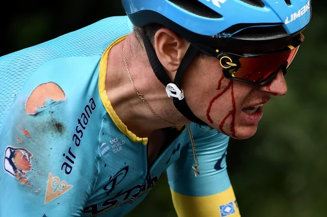 Okrvavljeni Jakob Fuglsang. V izjavi po koncu prve etape je njegov športni direktor Aleksander Vinokurov dejal, da sicer Fuglsanga še pregledujejo, da pa ne kaže na kakšno hujšo poškodbo. FOTO: Reuters