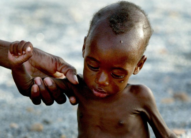 Za lakoto po svetu trpi najmanj 135 milijonov ljudi, v svetovnem programu za hrano pri Združenih narodih pa opozarjajo, da bi se lahko zaradi koronakrize njihovo število v enem letu podvojilo. FOTO: Finbarr O'Reilly/Reuters