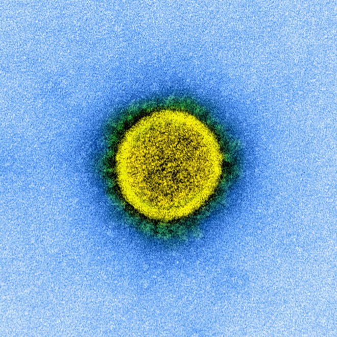 Virus sars-cov-2, ki povzroča bolezen covid-19. FOTO: Reuters