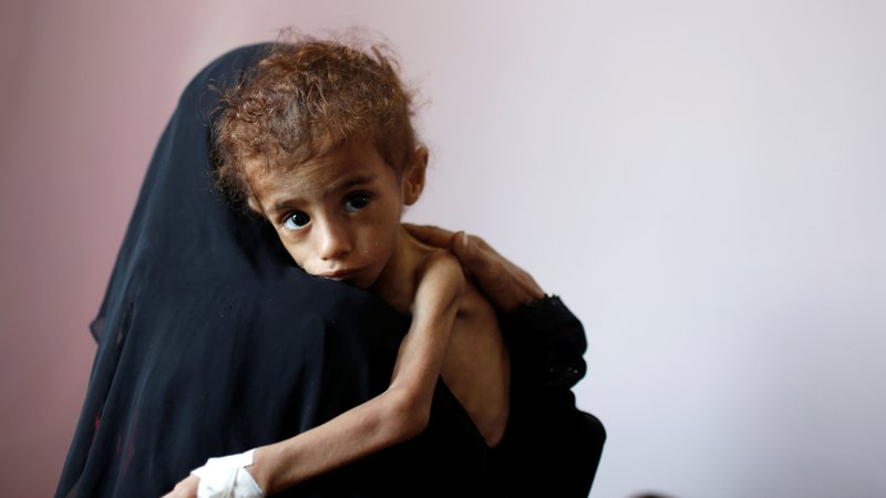 Fotografija: Podobe shiranih in umirajočih otrok iz Jemna so podobe prihodnjih vojn, v katerih bodo odigrale pomembno vlogo podnebne spremembe. FOTO:Reuters