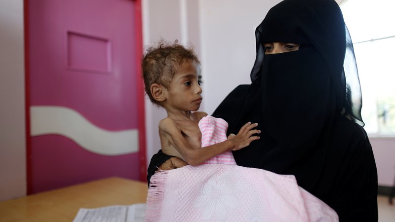 Fotografija: Vojna v Jemnu je povzročila veliko lakoto, zaradi katere naj bi umrlo že 85.000 otrok. FOTO Reuters