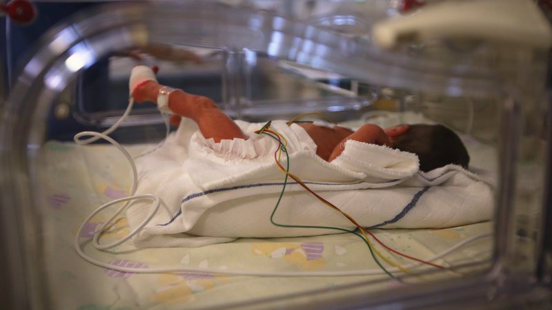 Fotografija: Nekateri novorojenčki se narodijo s prirojeno okvaro srca in potrebujejo pomoč zdravnikov takoj. Foto Igor Zaplatil/ Delo
