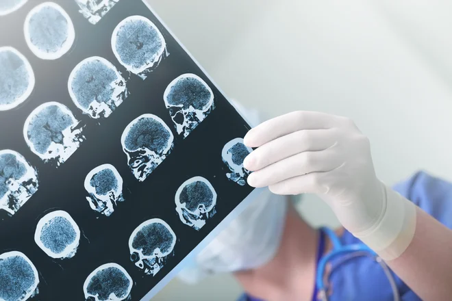 Z napredkom znanosti postaja pojem svobodne volje zastarel. FOTO: Getty Images/istockphoto