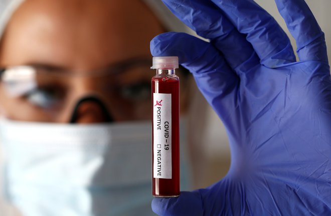 V BiH število okužb z novim koronavirusom že nekaj časa vztrajno narašča. FOTO: Dado Ruvic/Reuters