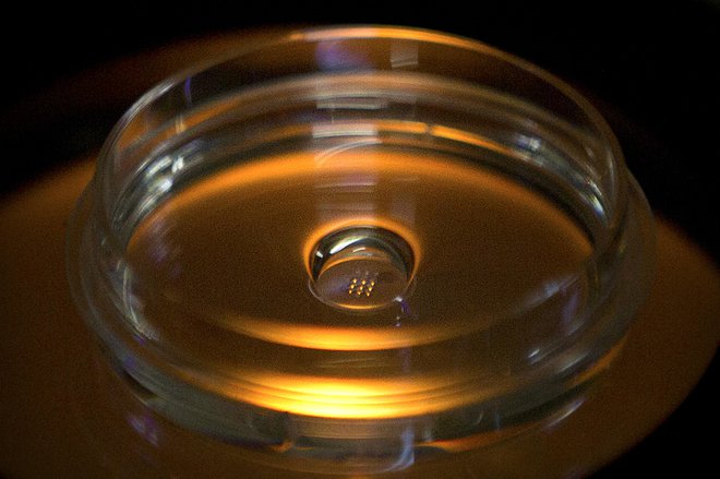 Embrio s spremenjenimi geni v laboratoriju v kitajskem mestu Shenzhen FOTO: Mark Schiefelbein/AP