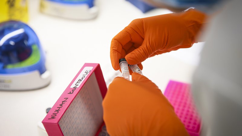 Fotografija: Cepivo, na katerega stavimo (in ga financiramo) v EU, je oxfordsko cepivo, ki vsebuje opičji prehladni virus. FOTO: Jože Suhadolnik/Delo
