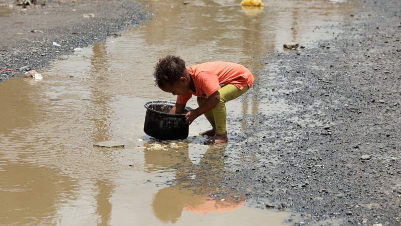Fotografija: Stotisočim jemenskim otrokom grozi smrt zaradi lakote.
FOTO: Khaled Abdullah/Reuters