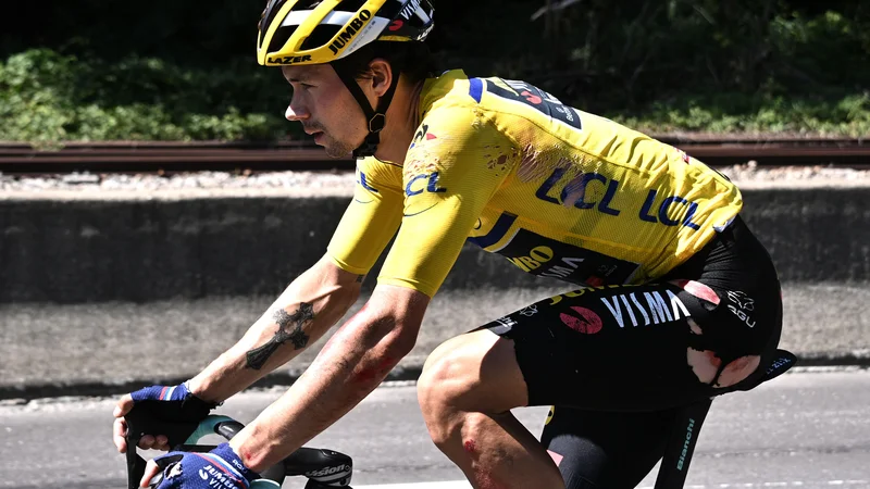 Fotografija: Primož Roglič si je pri padcu v 4. etapi kriterija Dauphine posnel kar nekaj kože. FOTO: Anne-Christine Poujoulat/AFP