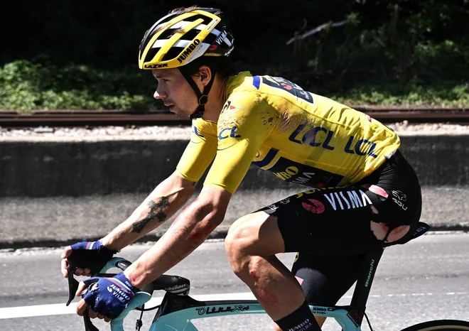 Primož Roglič si je pri padcu v 4. etapi kriterija Dauphine posnel kar nekaj kože. FOTO: Anne-Christine Poujoulat/AFP