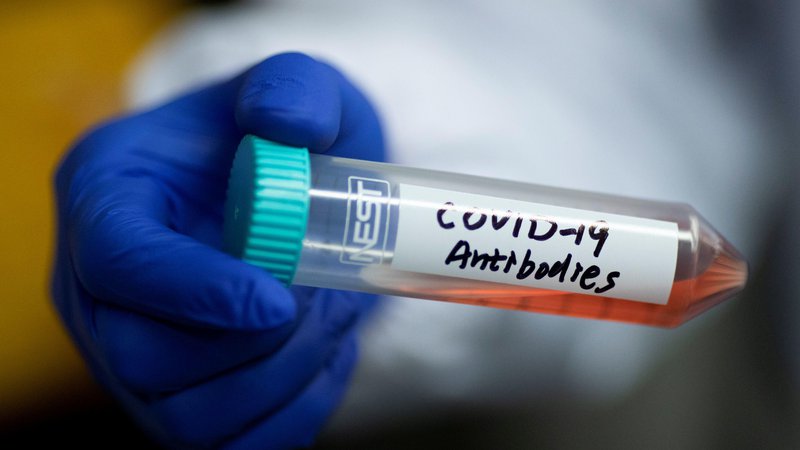 Fotografija: Zakaj naložiti aplikacijo za sledenje možnosti okužbe s koronavirusom? Foto Thomas Peter/Reuters