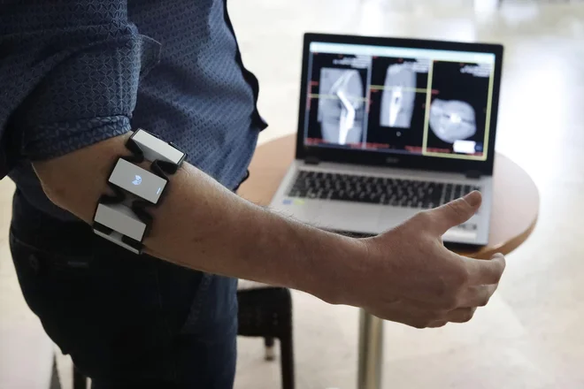 Digitalnega kirurškega asistenta sestavljata programska oprema in elektromagnetna bluetooth zapestnica. FOTO: Leon Vidic