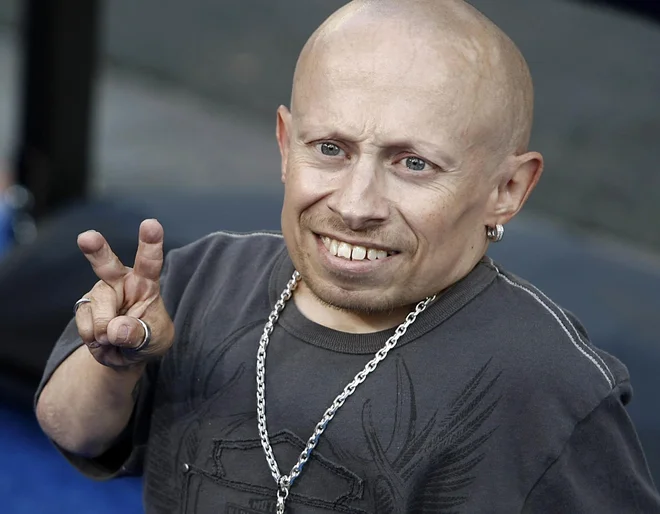 Verne Troyer je vrhunec doživel z vlogo zlobnega Mini Jaz oz. Mini Me v filmih Austin Powers in Austin Powers: vohun ki me je nategnil. FOTO: AP Photo/Dan Steinberg
