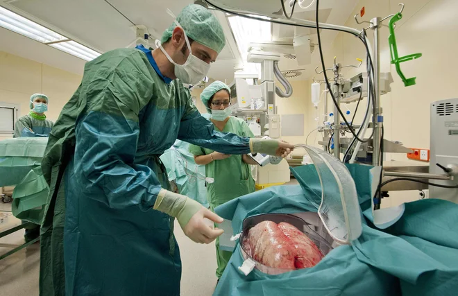 Transplantacija pljuč v Nemčiji. FOTO: Reuters/Reuters