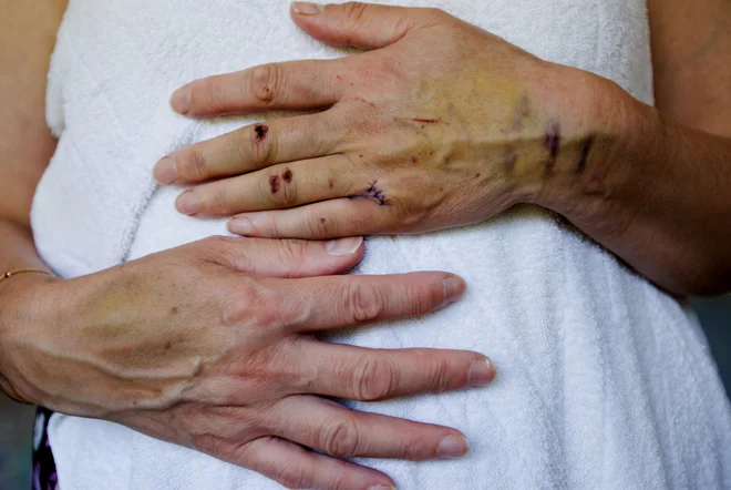 Žrtve se bojijo, da bi razkritje še povečalo njihovo ogroženost in jih pripeljalo v še hujšo stisko. FOTO Shutterstock