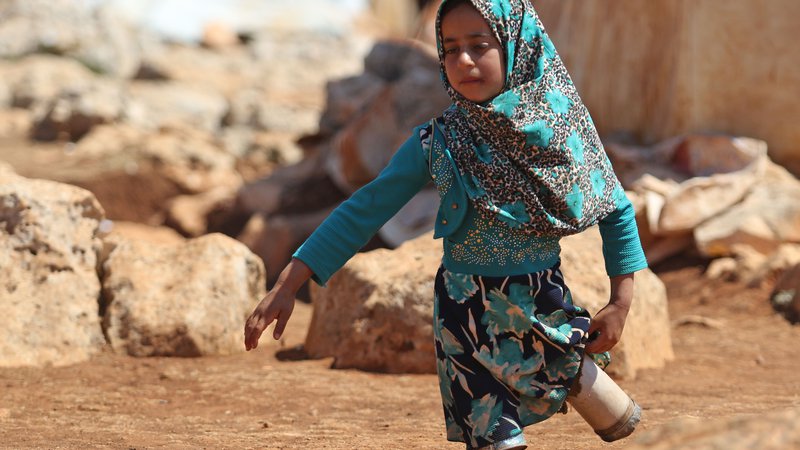 Fotografija: Portret osemletne sirske deklice Maye Mohammad Ali Merhi, ki se je rodila brez spodnjih udov. Ker ji družina ni mogla privoščiti pravih protetičnih udov, jih je oče naredil kar iz pločevink, napolnjenih z bombažem in ostankov krp. Njena družina je morala zaradi vojne zapustiti Alep. FOTO: Aref Vatad/AFP
