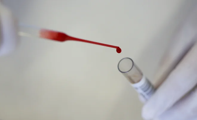 FOTO: Reuters