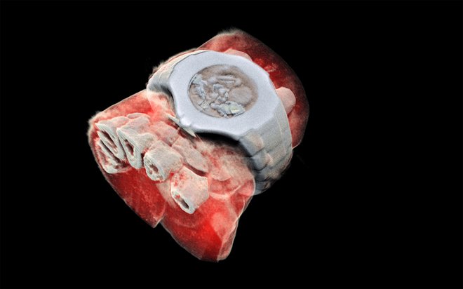 3-D zapestja z uro. Kosti so bele, mehko tkivo je obarvano rdeče.<br />
FOTO: AFP