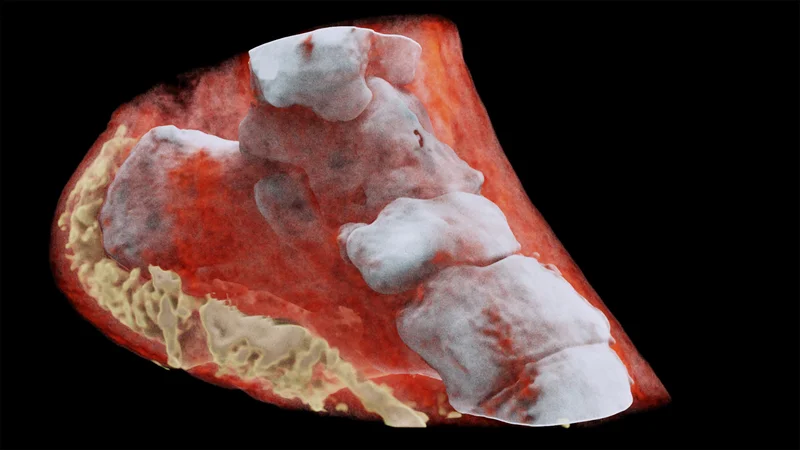 Fotografija: Gleženj, kot ga posname MARS Bioimaging. Na posnetkih bi lahko z visoko natančnostjo razločili morebitne rakave tvorbe. FOTO: AFP