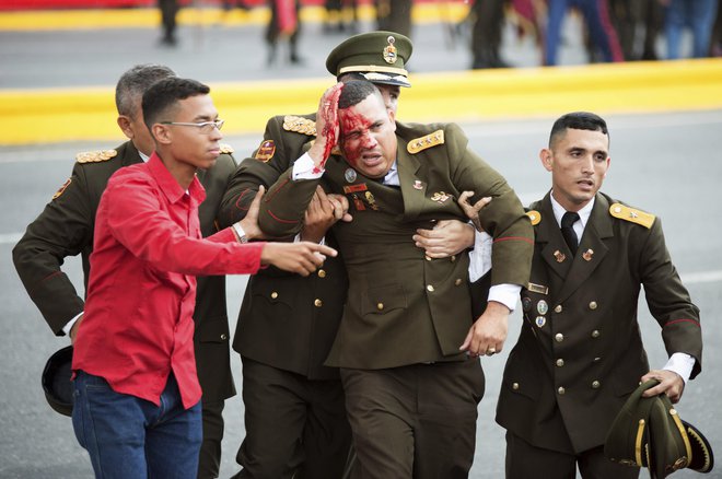 Poškodbe je utrpel eden od venezuelskih vojakov. FOTO: AP