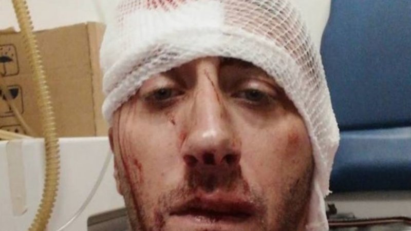 Fotografija: Vladimir Kovačevič je utrpel poškodbe glave, ne ve pa, kdo ga je napadel. FOTO: BN TV