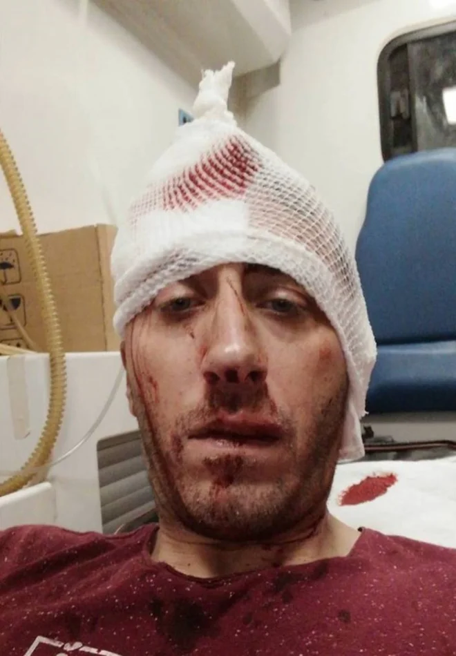 Vladimir Kovačevič je utrpel poškodbe glave, ne ve pa, kdo ga je napadel. FOTO: BN TV