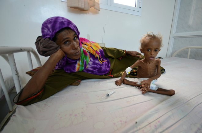 Unicef opozarja na spregledano krizo v Jemnu. FOTO: Abduljabbar Zeyad/Reuters