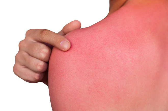Potekajo tudi raziskave, ali lahko višjo umrljivost povežejo z biološkimi in genetskimi faktorji. FOTO: Getty Images/iStockphoto
