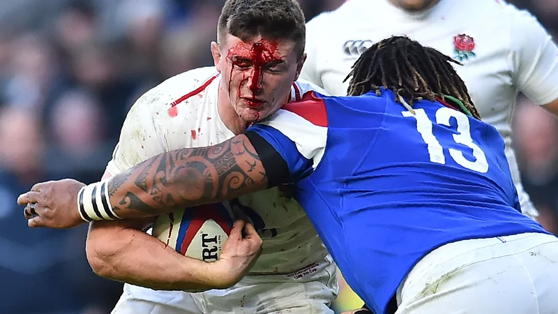 Fotografija: Na tekmi šestih narodov v ragbiju sta se v Londonu pomerili reprezentanci Anglije in Francije. Na fotografiji je okrvavljeni Anglež Tom Curry. FOTO: Glyn Kirk/AFP