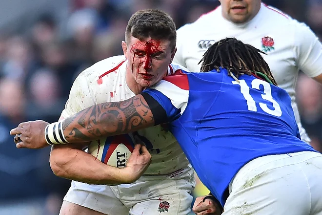 Na tekmi šestih narodov v ragbiju sta se v Londonu pomerili reprezentanci Anglije in Francije. Na fotografiji je okrvavljeni Anglež Tom Curry. FOTO: Glyn Kirk/AFP