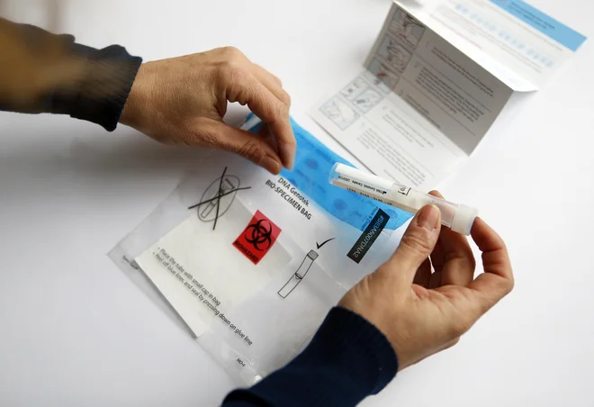 Preverjeno 5. 3. DNA test, v Ljubljani 20. december 2016 [DNA, testiranja] Foto Matej Družnik