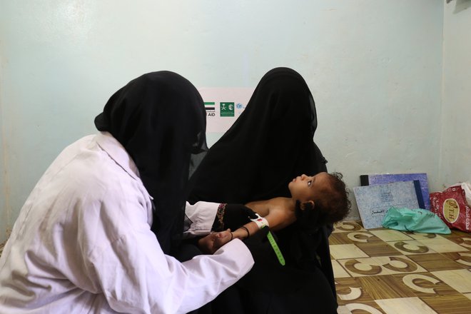 V Jemnu je več kot dva milijona dojenčkov in malčkov, ki še niso dopolnili pet let, podhranjenih. FOTO © UNICEF/UN0275788/Huwais