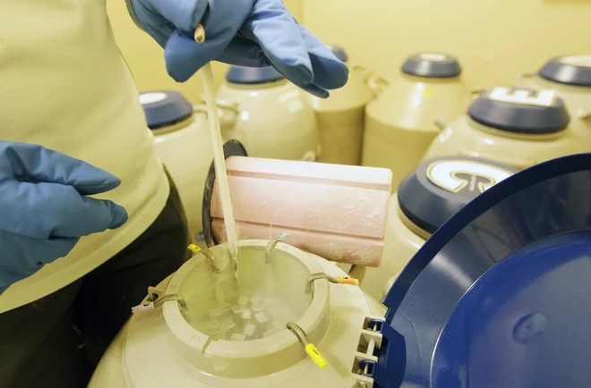 Konec osemdesetih let so ZDA zaradi nevarnosti okužbe s HIV prepovedali uporabo sveže sperme pri umetnih oploditvah. FOTO: Pichi Chuang/Reuters