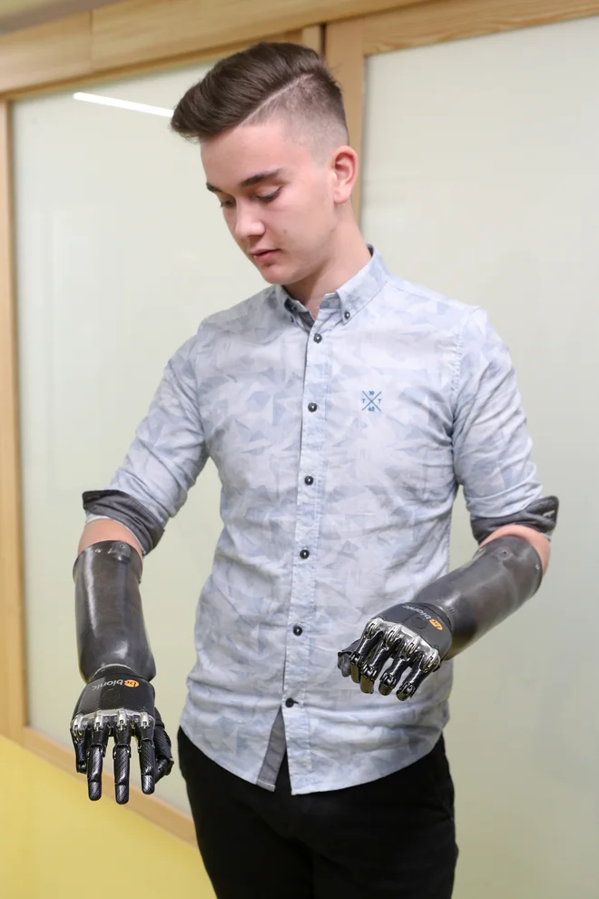 16-letni Martin Bučer ima po nesreči bionične dlani s prsti. FOTO: Marko Feist